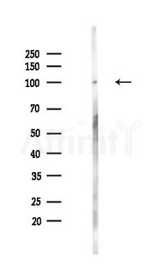 INTS5 Antibody - Western blot analysis of lysates from PC12 cells(UV,30min treatment), using INTS5 Antibody at 1/1000 dilution.
