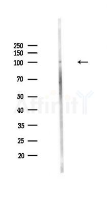 INTS5 Antibody - Western blot analysis of lysates from HepG2 cells(starvation,24h treatment), using INTS5 Antibody at 1/1000 dilution.