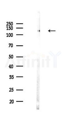 CLEC16A Antibody - Western blot analysis of lysates from Hela cells(LPS,4h treatment), using CLEC16A Antibody at 1/1000 dilution.