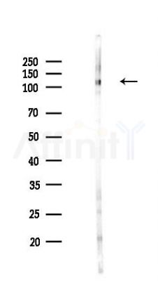 CLEC16A Antibody - Western blot analysis of lysates from COLO205 cells(LPS,4h treatment), using CLEC16A Antibody at 1/1000 dilution.