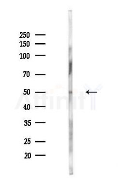 ZNF395 Antibody - Western blot analysis of lysates from PC12 cells(UV,30min treatment), using ZNF395 Antibody at 1/1000 dilution.