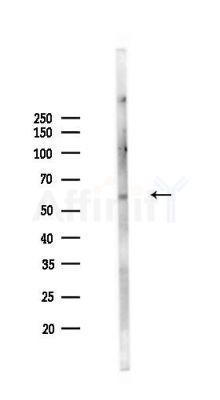 ZNF395 Antibody - Western blot analysis of lysates from Rat brain, using ZNF395 Antibody at 1/1000 dilution.