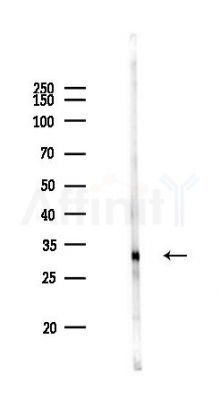 ECHDC2 Antibody - Western blot analysis of lysates from PC12 cells, using ECHDC2 Antibody at 1/1000 dilution.
