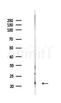 ARL1 Antibody - Western blot analysis of lysates from COLO205 cells(LPS,4h treatment), using ARL1 Antibody at 1/1000 dilution.