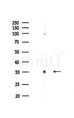 NUP35 Antibody - Western blot analysis of lysates from COLO205 cells(LPS,4h treatment), using NUP35 Antibody at 1/1000 dilution.
