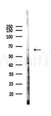 POTED Antibody - Western blot analysis of lysates from HepG2 cells(heat-shock,45min treatment), using POTED Antibody at 1/1000 dilution.