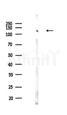 SRGAP1 Antibody - Western blot analysis of lysates from Hela cells(LPS,4h treatment), using SRGAP1 Antibody at 1/1000 dilution.
