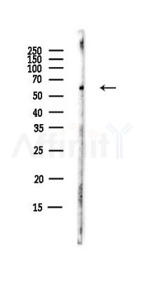 CARS2 Antibody - Western blot analysis of lysates from B16F10-LUC cells(starvation,24h treatment), using CARS2 Antibody at 1/1000 dilution.