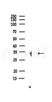 TLX1 Antibody - Western blot analysis of lysates from Rat muscle, using TLX1 Antibody at 1/1000 dilution.
