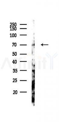 PRDM5 Antibody - Western blot analysis of lysates from Mouse lung, using PRDM5 Antibody at 1/1000 dilution.