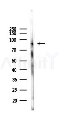 JPH2 Antibody - Western blot analysis of lysates from HepG2 cells(heat-shock,45min treatment), using JPH2 Antibody at 1/1000 dilution.