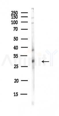 RHOU Antibody - Western blot analysis of lysates from HUVEC cells(UV,30min treatment), using RHOU Antibody at 1/1000 dilution.