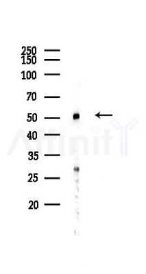 IPCEF1 Antibody - Western blot analysis of lysates from Mouse lung, using IPCEF1 Antibody at 1/1000 dilution.