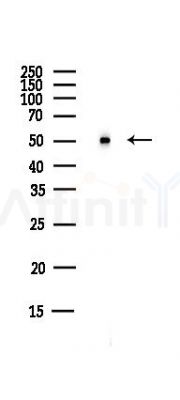 IPCEF1 Antibody - Western blot analysis of lysates from HUVEC cells(UV,30min treatment), using IPCEF1 Antibody at 1/1000 dilution.