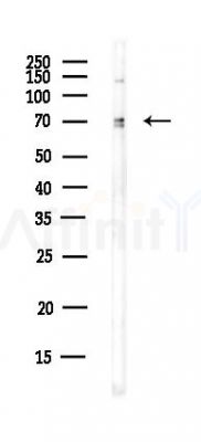 ARID5A Antibody - Western blot analysis of lysates from HUVEC cells(UV,30min treatment), using ARID5A Antibody at 1/1000 dilution.