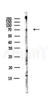 ARID5A Antibody - Western blot analysis of lysates from B16F10-LUC cells(starvation,24h treatment), using ARID5A Antibody at 1/1000 dilution.