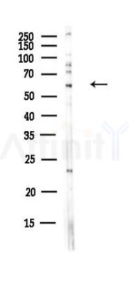 SMARCD2 Antibody - Western blot analysis of lysates from HUVEC cells(UV,30min treatment), using SMARCD2 Antibody at 1/1000 dilution.