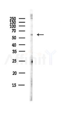 SMARCD2 Antibody - Western blot analysis of lysates from B16F10-LUC cells(starvation,24h treatment), using SMARCD2 Antibody at 1/1000 dilution.