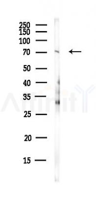 TNS4 Antibody - Western blot analysis of lysates from HUVEC cells(UV,30min treatment), using TNS4 Antibody at 1/1000 dilution.