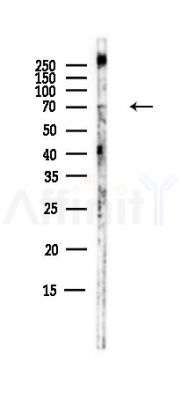 TNS4 Antibody - Western blot analysis of lysates from B16F10-LUC cells(starvation,24h treatment), using TNS4 Antibody at 1/1000 dilution.