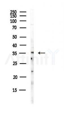 DDAH1 Antibody - Western blot analysis of lysates from HUVEC cells(UV,30min treatment), using DDAH1 Antibody at 1/1000 dilution.