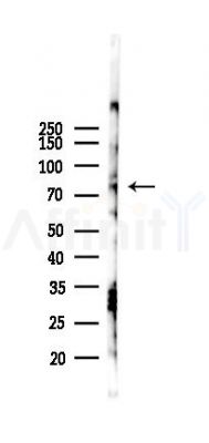 SLC15A2 Antibody - Western blot analysis of lysates from Rat brain, using SLC15A2 Antibody at 1/1000 dilution.