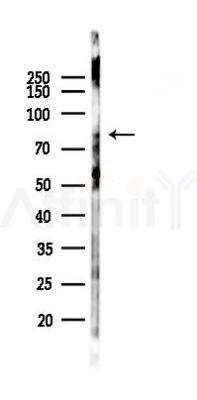 SLC15A2 Antibody - Western blot analysis of lysates from HepG2 cells(heat-shock,45min treatment), using SLC15A2 Antibody at 1/1000 dilution.