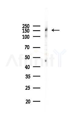 RPRD2 Antibody - Western blot analysis of lysates from Mouse liver, using RPRD2 Antibody at 1/1000 dilution.