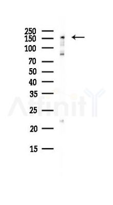 RPRD2 Antibody - Western blot analysis of lysates from Hela cells(heat-shock, 45min treatment), using RPRD2 Antibody at 1/1000 dilution.
