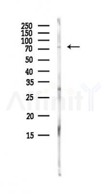 NDC1 Antibody - Western blot analysis of lysates from 3T3-L1 P6(heat-shock, 45min treatment), using NDC1 Antibody at 1/1000 dilution.