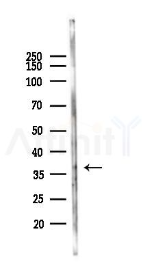 SLC39A11 Antibody - Western blot analysis of lysates from HepG2 cells(heat-shock,45min treatment), using SLC39A11 Antibody at 1/1000 dilution.