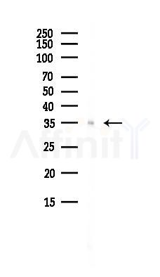 RBM7 Antibody - Western blot analysis of lysates from Hela cells(heat-shock, 45min treatment), using RBM7 Antibody at 1/1000 dilution.