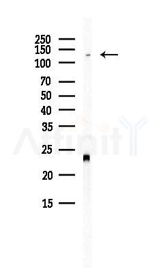 ATF7IP Antibody - Western blot analysis of lysates from Hela cells(heat-shock, 45min treatment), using ATF7IP Antibody at 1/1000 dilution.