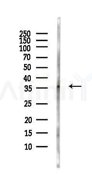 PARP16 Antibody - Western blot analysis of lysates from HepG2 cells(LPS, 4h treatment), using PARP16 Antibody at 1/1000 dilution.