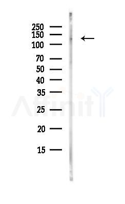 DHX30 Antibody - Western blot analysis of lysates from Hela cells(heat-shock, 45min treatment), using DHX30 Antibody at 1/1000 dilution.