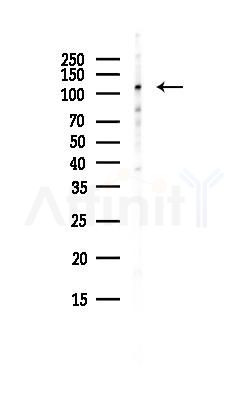 POP1 Antibody - Western blot analysis of lysates from Hela cells(heat-shock, 45min treatment), using POP1 Antibody at 1/1000 dilution.