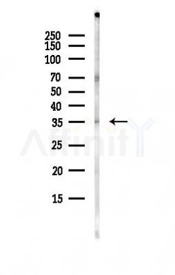 RDH11 Antibody - Western blot analysis of lysates from Hela cells(heat-shock, 45min treatment), using RDH11 Antibody at 1/1000 dilution.