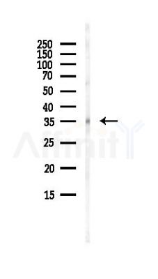 RDH11 Antibody - Western blot analysis of lysates from 3T3-L1 P6(heat-shock, 45min treatment), using RDH11 Antibody at 1/1000 dilution.