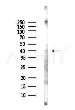 MCUR1 Antibody - Western blot analysis of lysates from EC304 cells(LPS, 4h treatment), using MCUR1 Antibody at 1/1000 dilution.