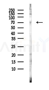 GRHL2 Antibody - Western blot analysis of lysates from HepG2 cells(LPS, 4h treatment), using GRHL2 Antibody at 1/1000 dilution.