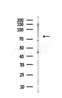 NCAPH2 Antibody - Western blot analysis of lysates from Mouse liver, using NCAPH2 Antibody at 1/1000 dilution.