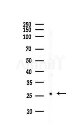 TFPI2 Antibody - Western blot analysis of lysates from Mouse liver, using TFPI2 Antibody at 1/1000 dilution.