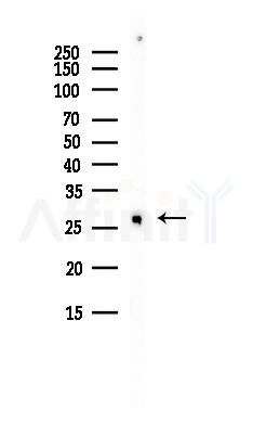TFPI2 Antibody - Western blot analysis of lysates from Hela cells(heat-shock, 45min treatment), using TFPI2 Antibody at 1/1000 dilution.