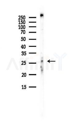 TFPI2 Antibody - Western blot analysis of lysates from 3T3-L1 P6(heat-shock, 45min treatment), using TFPI2 Antibody at 1/1000 dilution.