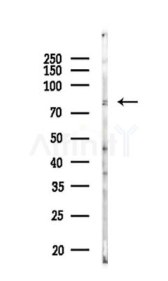TRIM67 Antibody - Western blot analysis of lysates from Mouse liver, using TRIM67 Antibody at 1/1000 dilution.