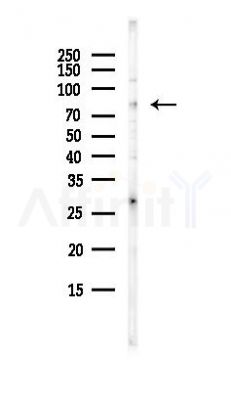 TRIM67 Antibody - Western blot analysis of lysates from Hela cells(heat-shock, 45min treatment), using TRIM67 Antibody at 1/1000 dilution.