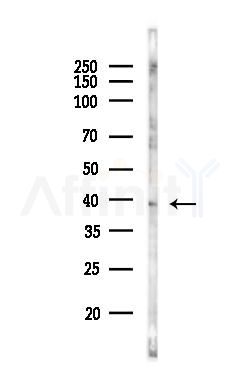 RDH12 Antibody - Western blot analysis of lysates from 3T3-L1 P6(heat-shock, 45min treatment), using RDH12 Antibody at 1/1000 dilution.