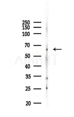 GATAD2A Antibody - Western blot analysis of lysates from Mouse liver, using GATAD2A Antibody at 1/1000 dilution.