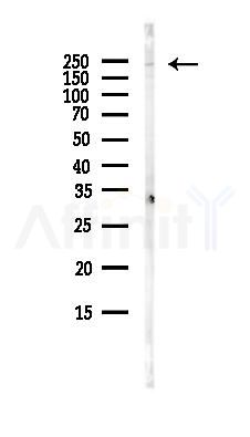 MED13L Antibody - Western blot analysis of lysates from 3T3-L1 P6(heat-shock, 45min treatment), using MED13L Antibody at 1/1000 dilution.