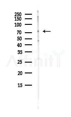 PAN3 Antibody - Western blot analysis of lysates from Hela cells(heat-shock, 45min treatment), using PAN3 Antibody at 1/1000 dilution.